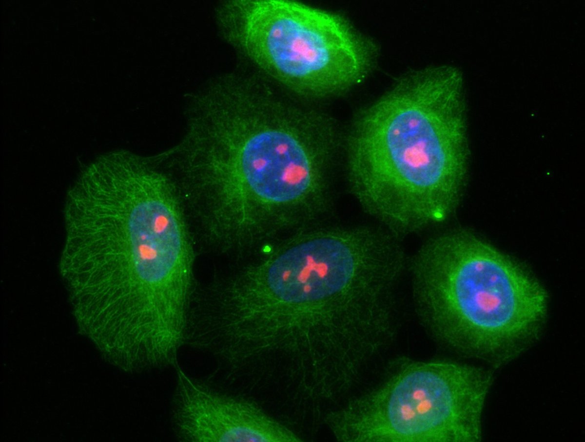 Fluoreszenzmarkierte Zellbestandteile