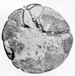 Jollos-1923-2: Details Image preview