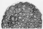 Jollos-1923-3a: Details Image preview