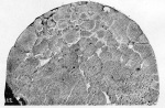 Jollos-1923-3b: Details Image preview