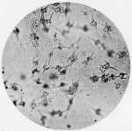 Lenz-1928-18: Details Image preview