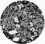 Lenz-1928-22: Details Image preview