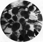Lenz-1928-5: Details Image preview