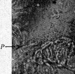 Peterfi-1924-2: Details Image preview