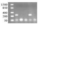PCR amplificates of 16S rDNA from genomic DNA of soil bacteria PCR amplificates of 16S rDNA from genomic DNA of soil bacteria