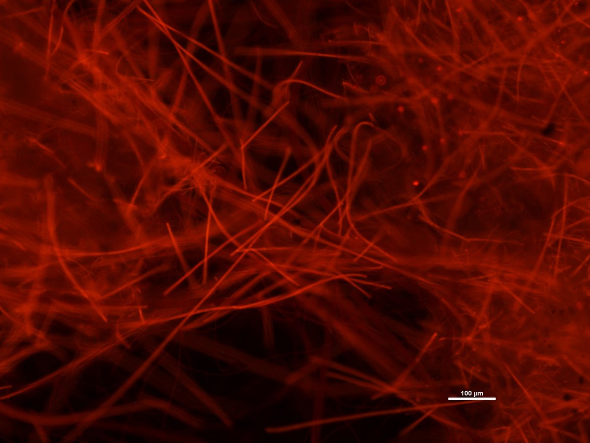 Fluoreszensmikroskopisches Bild von fädigen Cyanobakterien (Blaualgen), wahrscheinlich Oszillatoria