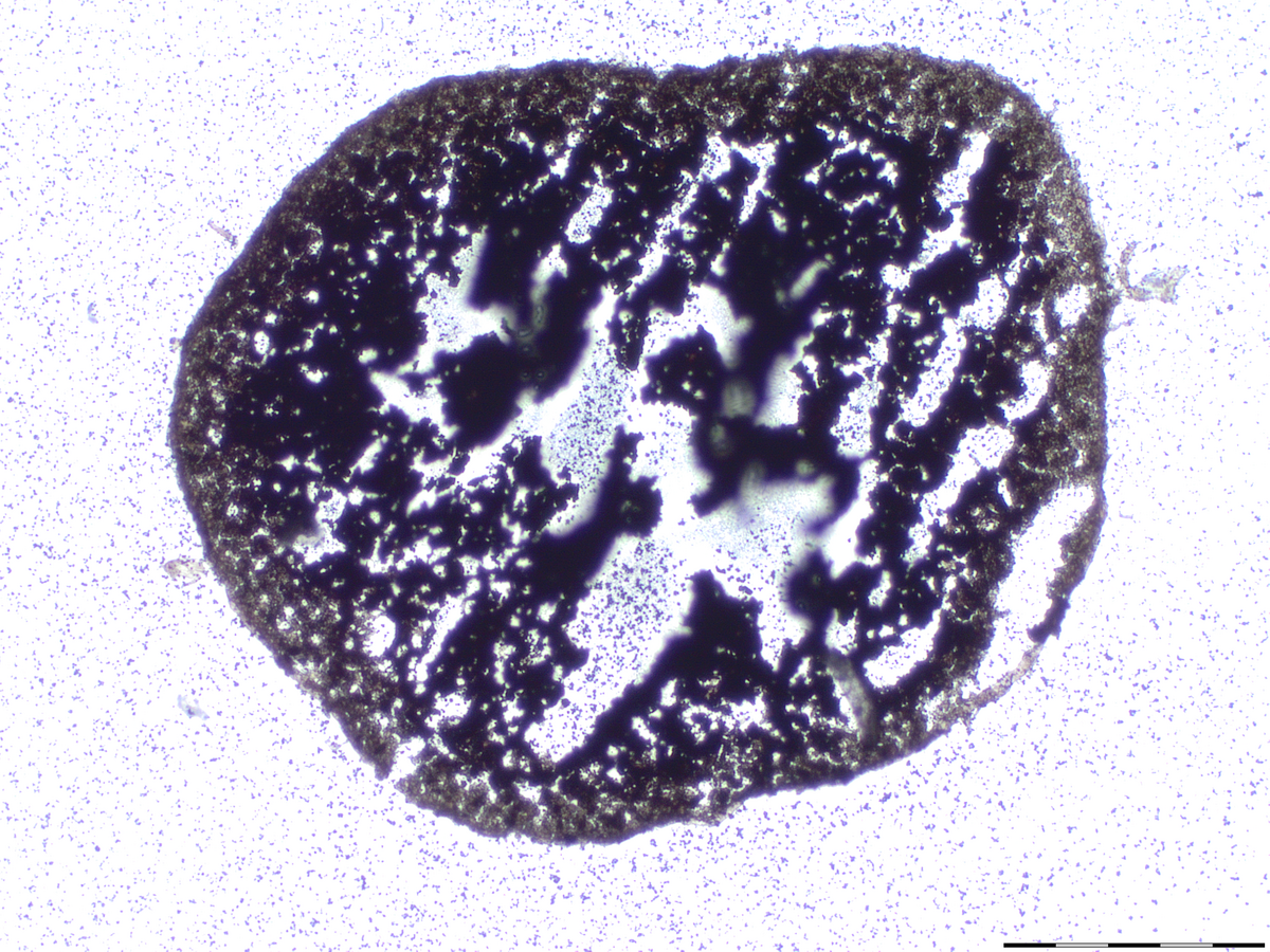 Calcium incorporation in the matrix (histological staining)