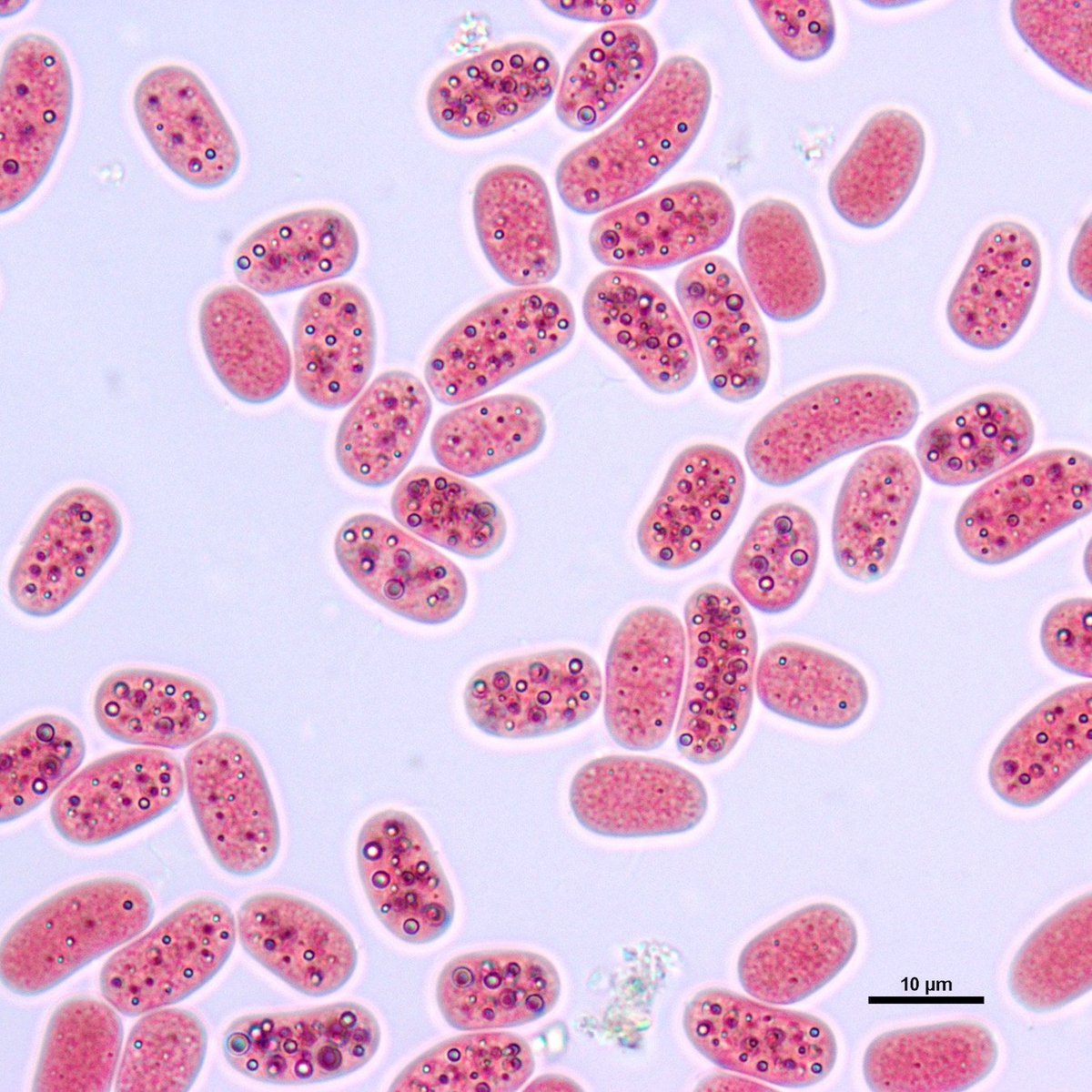 Foto von Schwefelbakterien