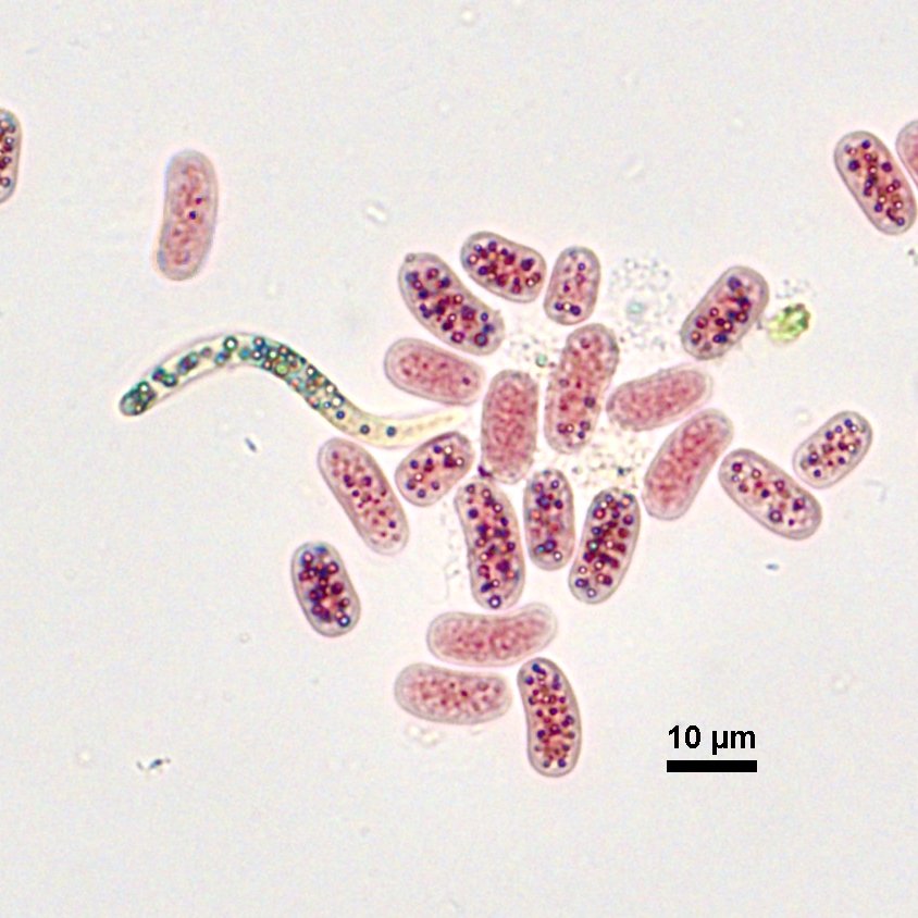 Foto von Schwefelbakterien