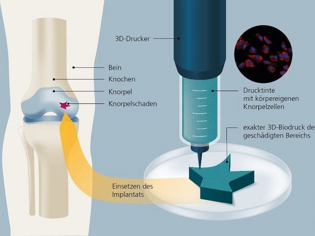 Schematische Darstellung zum Verfahren