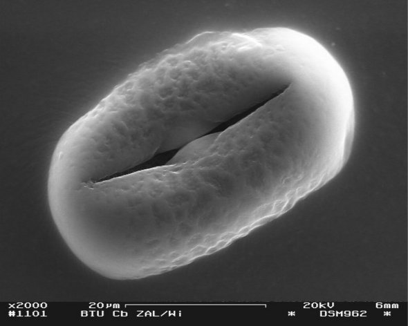 Electronic micrographs of pollen in studied subspecies of Linum