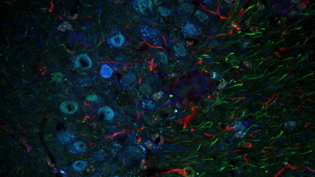 Mikroskopaufnahme Hippocampus