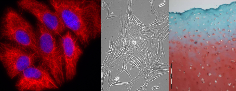 Links: Antikörperbasierter Nachweis des Zytoskeletts in Karzinomzellen (Fluoreszenzmikroskopie) Mitte: Humane Knorpelzellen in Kultur (Phasenkontrastmikroskopie) Rechts: Arthrotisches Knorpelgewebe aus dem Kniegelenk (SafraninO, Hellfeldmikroskopie) Antikörperbasierter Nachweis des Zytoskeletts in Karzinomzellen