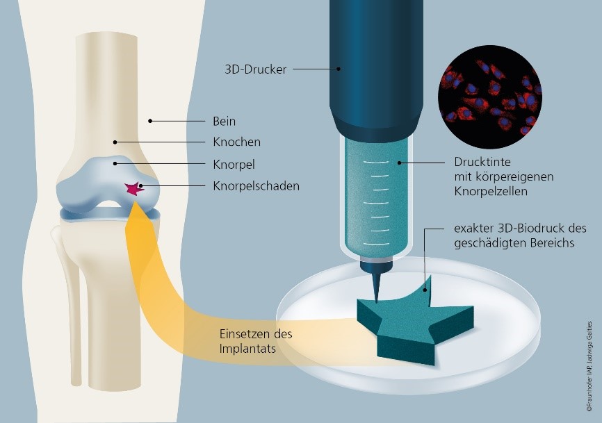 Schematische Darstellung zum Verfahren