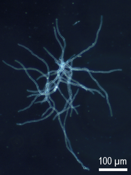 Mikroskopische Aufnahme von Aspergillus-Zellfäden in optimaler Kultur. Foto: Susanne Nieland